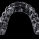 Bruxismus invisalign