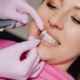 Verblendschalen bei Zahnschäden: Veneers