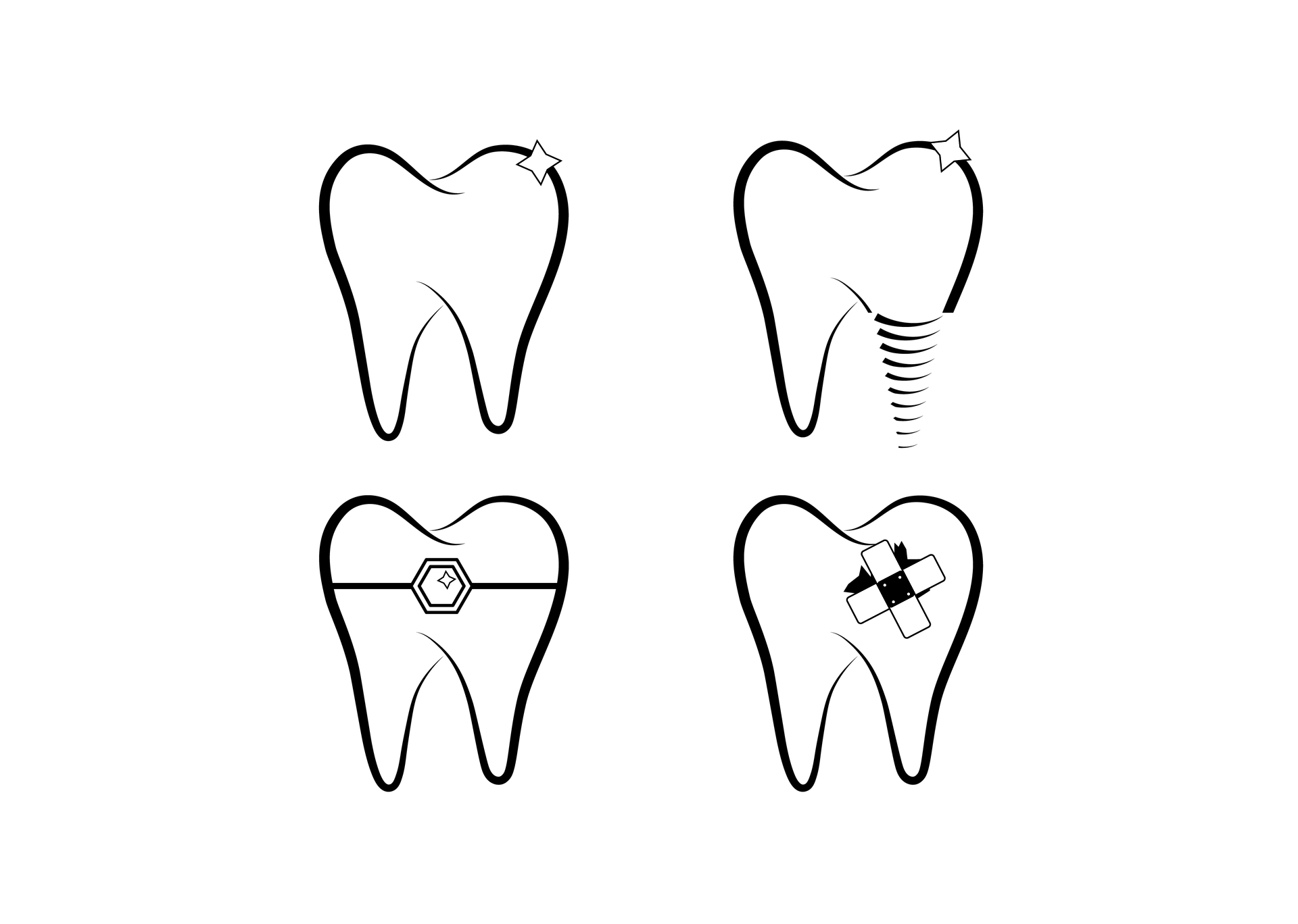 milchzähne